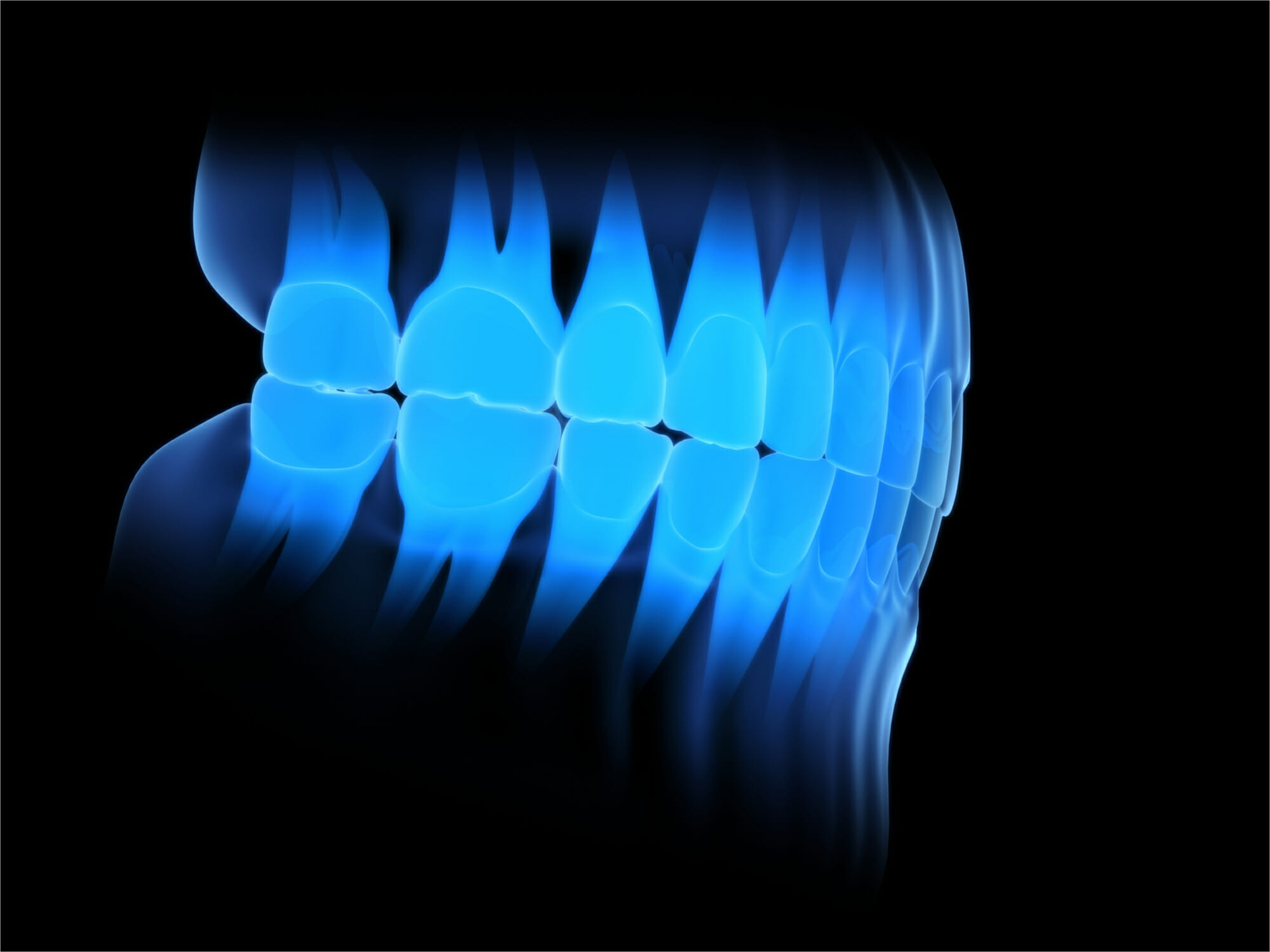 digital x-ray of teeth