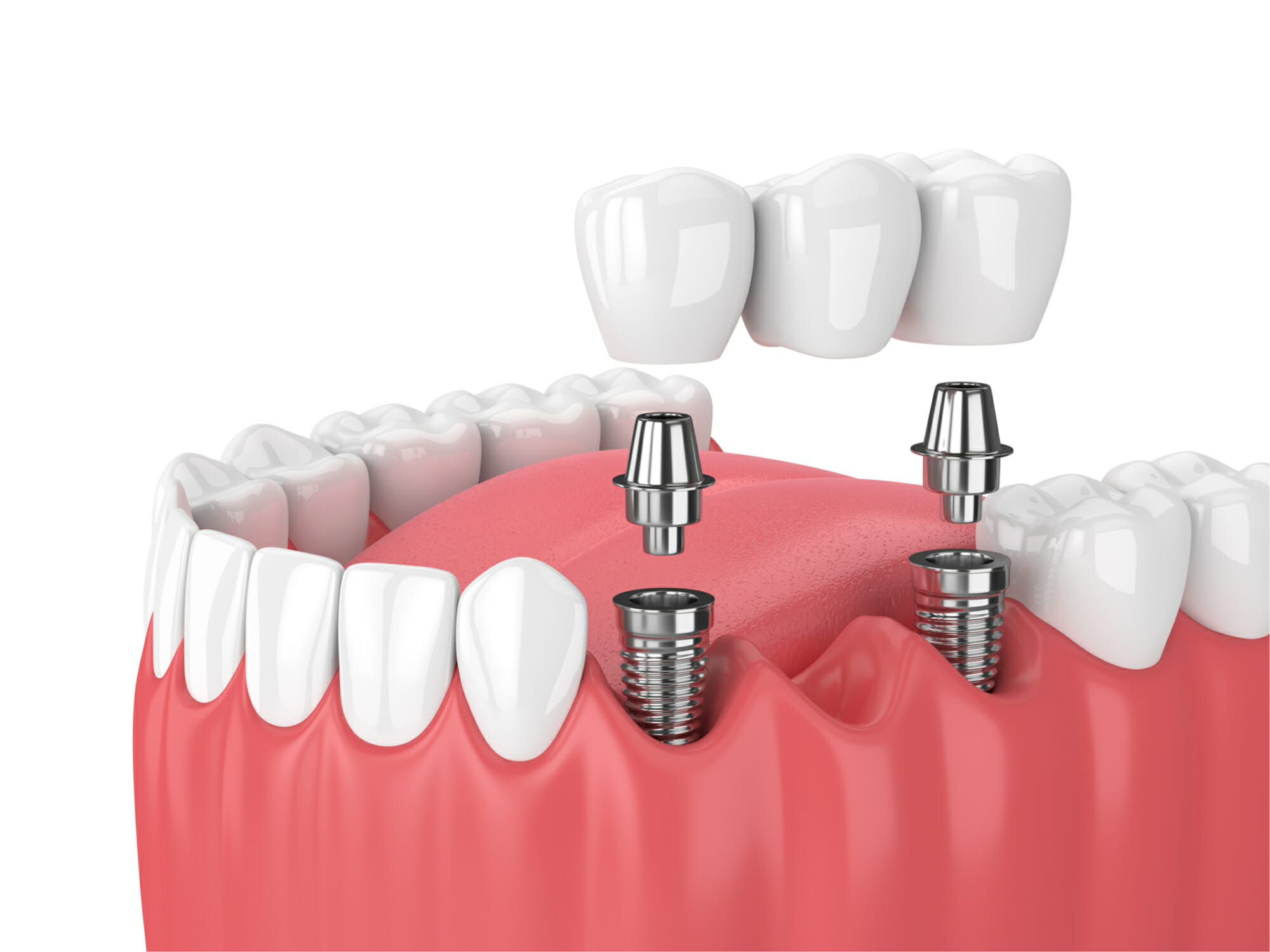 restorative dentistry